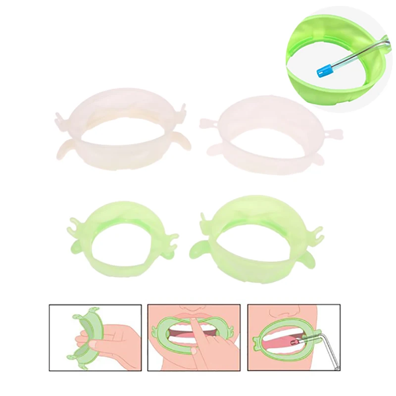 Teeth Whitening Accelerator - 3Pcs S/M/L 치과 립 뺨 리트랙터
