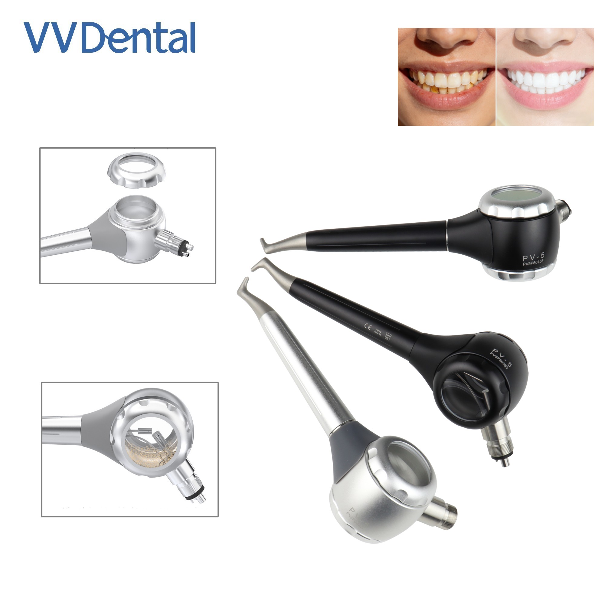 Teeth Whitening Usa - VV 치과용 2/4홀 치아 미백 샌드블라스팅