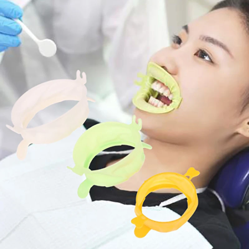 3Pcs S/M/L 치과 립 뺨 리트랙터 입 오프너 치 - Teeth Whitening Accelerator 리뷰 및 가격