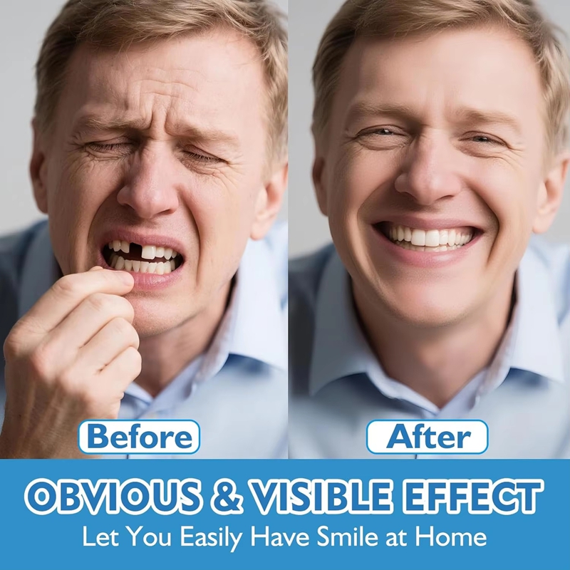 풀세트 실리콘 틀니 상하악 자연스러운 인공치아 편안한  - Teeth Whitening Instant 리뷰 및 가격