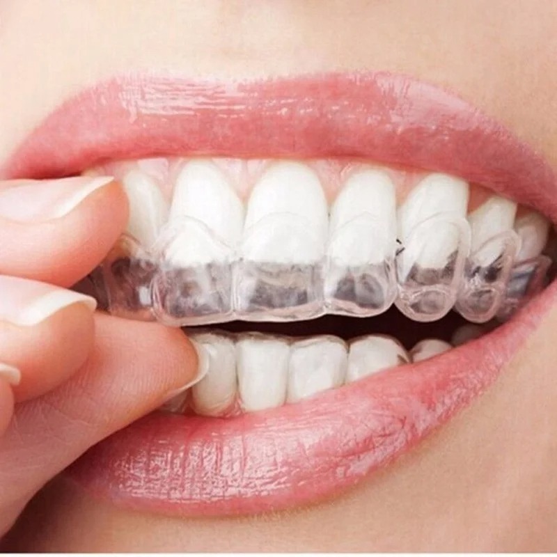 안티 코골이 Bruxism 슬리핑 입 가드 나이트 가드 - Teeth Whitening Mask 리뷰 및 가격