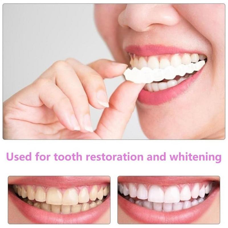 스냅온 치아 베니어, 즉각적인 실리콘 스마일 베니어,  - Teeth Whitening Mask 리뷰 및 가격