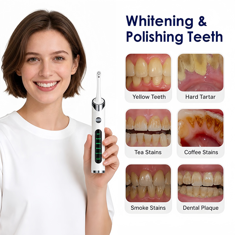 치아 광택기 치아 미백 키트, 치아 청소 및 미백용,  - Teeth Whitening Kit With Light 리뷰 및 가격