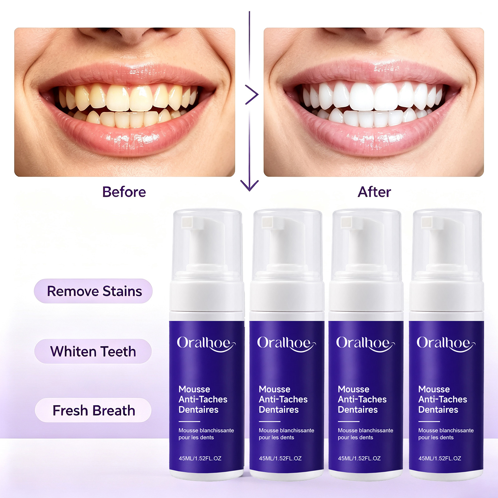 퍼플 포밍 치아 미백 치약 에나멜 안전 진주 화이트 폼 - Teeth Whitening Routine 리뷰 및 가격