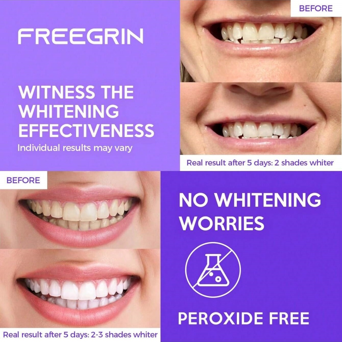 디럭스 화이트닝 치아 스티커 7/14/21 쌍 젤 화이 - Teeth Whitening Quotes 리뷰 및 가격